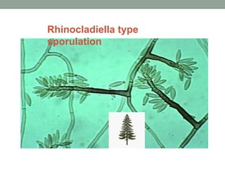 Rhinocladiella type
sporulation
 