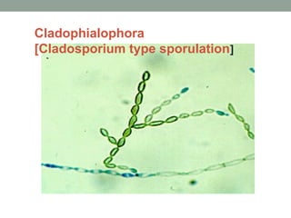 Cladophialophora
[Cladosporium type sporulation]
 