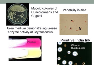Positive India Ink
Urea medium demonstrating urease
enzyme activity of Cryptococcus
Observe
Budding cells
Variability in s...