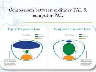 Comparison between ordinary PAL &
computer PAL
 