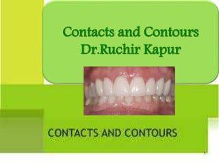 CONTACTS AND
CONTOURS
Contacts and Contours
Dr.Ruchir Kapur
1
 