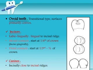 Transitional Teeth Contacts and Contours By Dr.Ruchir Kapur | PPTX