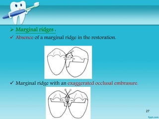 Contacts and Contours By Dr.Ruchir Kapur | PPTX