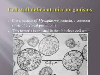  Cross-section of Mycoplasma bacteria, a common
cause of atypical pneumonia.
 This bacteria is unusual in that it lacks a cell wall.
 