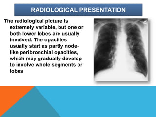 RADIOLOGICAL PRESENTATION
The radiological picture is
extremely variable, but one or
both lower lobes are usually
involved. The opacities
usually start as partly node-
like peribronchial opacities,
which may gradually develop
to involve whole segments or
lobes
 