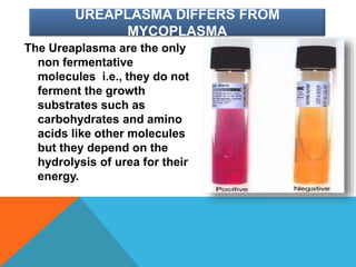 UREAPLASMA DIFFERS FROM
MYCOPLASMA
The Ureaplasma are the only
non fermentative
molecules i.e., they do not
ferment the growth
substrates such as
carbohydrates and amino
acids like other molecules
but they depend on the
hydrolysis of urea for their
energy.
 