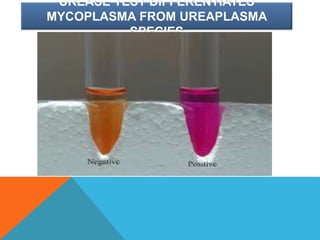 UREASE TEST DIFFERENTIATES
MYCOPLASMA FROM UREAPLASMA
SPECIES
 