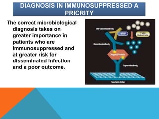 DIAGNOSIS IN IMMUNOSUPPRESSED A
PRIORITY
The correct microbiological
diagnosis takes on
greater importance in
patients who are
Immunosuppressed and
at greater risk for
disseminated infection
and a poor outcome.
 