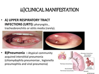 iii)CLINICAL MANIFESTATION
• A) UPPER RESPIRATORY TRACT
INFECTIONS (URTI): pharyngitis ,
tracheobronchitis or otitis media (rarely).
• B)Pneumonia : Atypical community
acquired interstitial pneumonia
(chlamydophila pneumoniae , legionella
pneumophila and viral pneumonia)
 