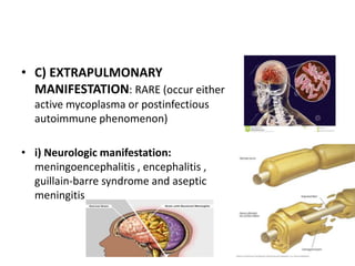• C) EXTRAPULMONARY
MANIFESTATION: RARE (occur either
active mycoplasma or postinfectious
autoimmune phenomenon)
• i) Neurologic manifestation:
meningoencephalitis , encephalitis ,
guillain-barre syndrome and aseptic
meningitis
 