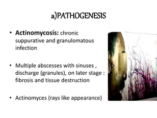 a)PATHOGENESIS
• Actinomycosis: chronic
suppurative and granulomatous
infection
• Multiple abscesses with sinuses ,
discharge (granules), on later stage :
fibrosis and tissue destruction
• Actinomyces (rays like appearance)
 