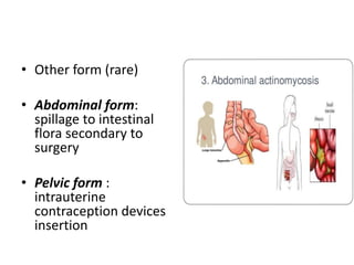 • Other form (rare)
• Abdominal form:
spillage to intestinal
flora secondary to
surgery
• Pelvic form :
intrauterine
contraception devices
insertion
 