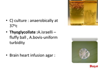 • C) culture : anaerobically at
37oc
• Thyoglycollate :A.israelli –
fluffy ball , A.bovis-uniform
turbidity
• Brain heart infusion agar :
 