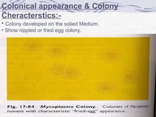 Colonical appearance & Colony
Cheracterstics:-
• Colony developed on the solied Medium.
• Show nippled or fried egg colony.
 