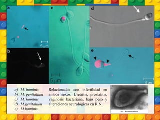 a) M. hominis
b) M. genitalium
c) M. hominis
d) M.genitalium
e) M.hominis
Relacionados con infertilidad en
ambos sexos. Uretritis, prostatitis,
vaginosis bacteriana, bajo peso y
alteraciones neurológicas en R.N.
 