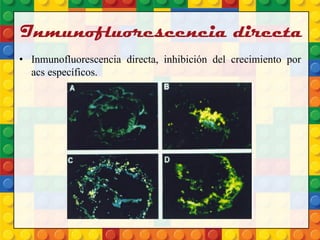 Inmunofluorescencia directa
• Inmunofluorescencia directa, inhibición del crecimiento por
acs específicos.
 