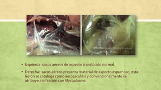 ▪ Izquierda: sacos aéreos de aspecto translúcido normal.
▪ Derecha: sacos aéreos presenta material de aspecto espumoso; esta
lesión se cataloga como aerosaculitis y convencionalmente se
atribuye a infección con Mycoplasma
 