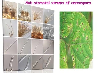 Sub stomatal stroma of cercospora
 