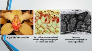 Cymbidum orchid Orchid pelotons stained
red in a light micrograph
of sectioned tissue.
Scaning
electronmicrograph of
orchid pelotons
 