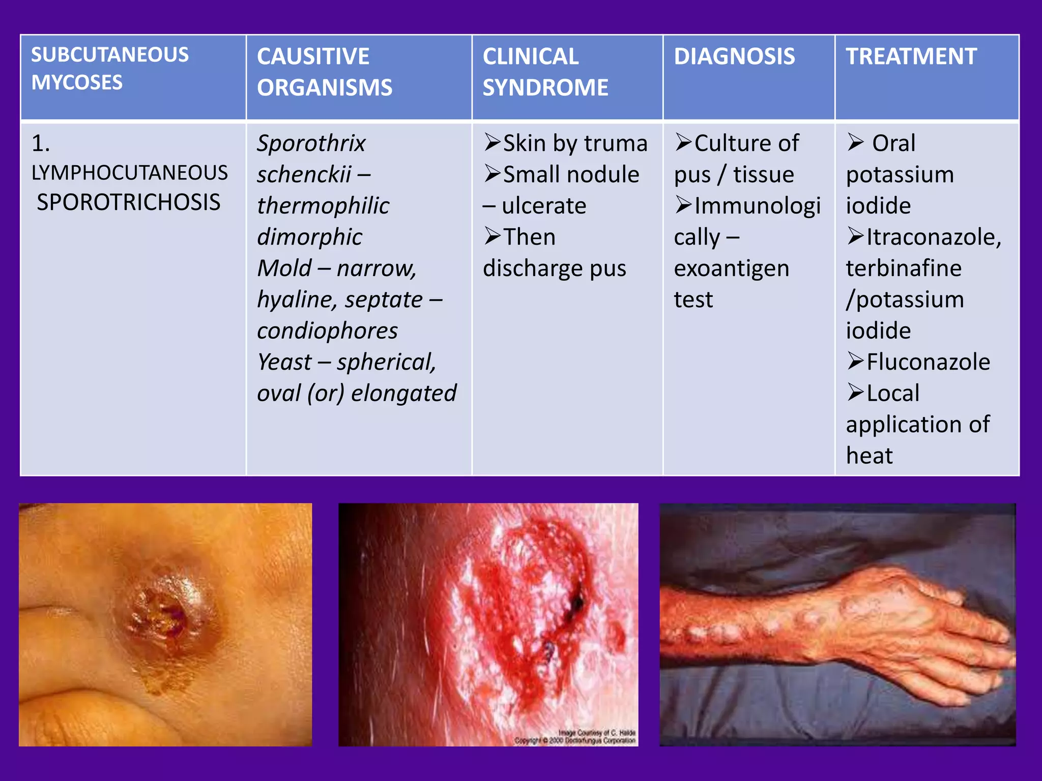 SUBCUTANEOUS      CAUSITIVE             CLINICAL         DIAGNOSIS      TREATMENT
MYCOSES           ORGANISMS             SYNDROME

1.                Sporothrix            Skin by truma   Culture of     Oral
LYMPHOCUTANEOUS   schenckii –           Small nodule    pus / tissue   potassium
SPOROTRICHOSIS    thermophilic          – ulcerate       Immunologi    iodide
                  dimorphic             Then            cally –        Itraconazole,
                  Mold – narrow,        discharge pus    exoantigen     terbinafine
                  hyaline, septate –                     test           /potassium
                  condiophores                                          iodide
                  Yeast – spherical,                                    Fluconazole
                  oval (or) elongated                                   Local
                                                                        application of
                                                                        heat
 