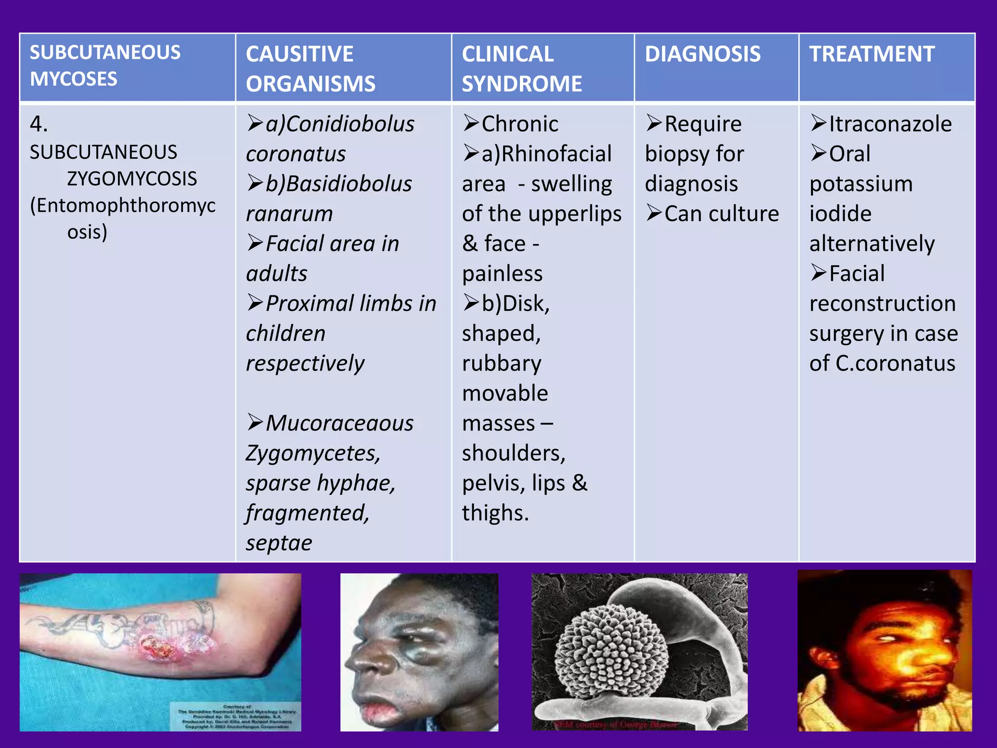 SUBCUTANEOUS        CAUSITIVE            CLINICAL           DIAGNOSIS      TREATMENT
MYCOSES             ORGANISMS            SYNDROME
4.                  a)Conidiobolus      Chronic           Require       Itraconazole
SUBCUTANEOUS        coronatus            a)Rhinofacial     biopsy for     Oral
    ZYGOMYCOSIS     b)Basidiobolus      area - swelling    diagnosis      potassium
(Entomophthoromyc   ranarum              of the upperlips   Can culture   iodide
    osis)
                    Facial area in      & face -                          alternatively
                    adults               painless                          Facial
                    Proximal limbs in   b)Disk,                          reconstruction
                    children             shaped,                           surgery in case
                    respectively         rubbary                           of C.coronatus
                                         movable
                    Mucoraceaous        masses –
                    Zygomycetes,         shoulders,
                    sparse hyphae,       pelvis, lips &
                    fragmented,          thighs.
                    septae
 
