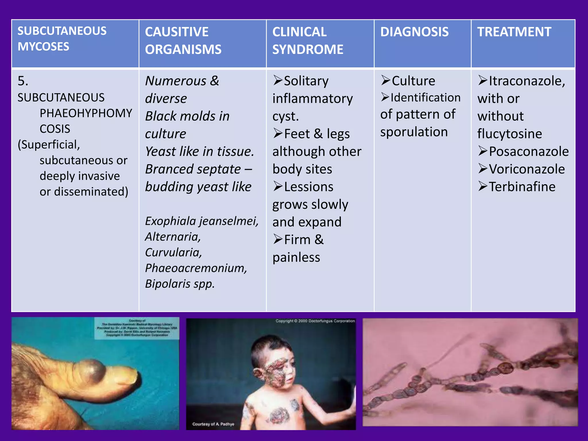SUBCUTANEOUS          CAUSITIVE              CLINICAL        DIAGNOSIS         TREATMENT
MYCOSES               ORGANISMS              SYNDROME

5.                   Numerous &             Solitary        Culture          Itraconazole,
SUBCUTANEOUS         diverse                inflammatory     Identification   with or
    PHAEOHYPHOMY Black molds in             cyst.            of pattern of     without
    COSIS            culture                Feet & legs     sporulation       flucytosine
(Superficial,
                     Yeast like in tissue.  although other                     Posaconazole
    subcutaneous or
    deeply invasive  Branced septate –      body sites                         Voriconazole
    or disseminated) budding yeast like     Lessions                          Terbinafine
                                            grows slowly
                      Exophiala jeanselmei, and expand
                      Alternaria,           Firm &
                      Curvularia,           painless
                      Phaeoacremonium,
                      Bipolaris spp.
 