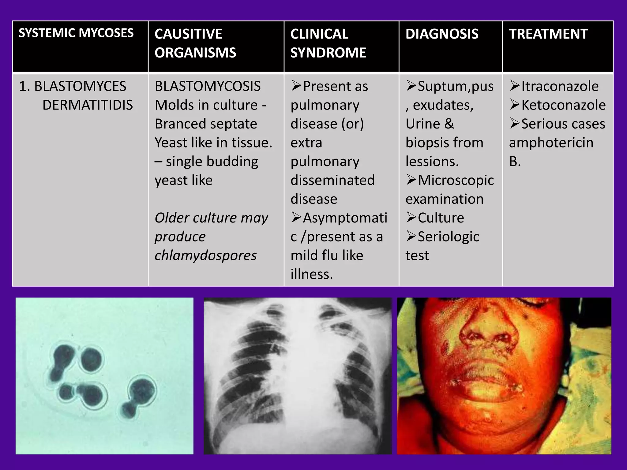 SYSTEMIC MYCOSES   CAUSITIVE               CLINICAL          DIAGNOSIS      TREATMENT
                   ORGANISMS               SYNDROME

1. BLASTOMYCES     BLASTOMYCOSIS           Present as       Suptum,pus    Itraconazole
    DERMATITIDIS   Molds in culture -      pulmonary         , exudates,    Ketoconazole
                   Branced septate         disease (or)      Urine &        Serious cases
                   Yeast like in tissue.   extra             biopsis from   amphotericin
                   – single budding        pulmonary         lessions.      B.
                   yeast like              disseminated      Microscopic
                                           disease           examination
                   Older culture may       Asymptomati      Culture
                   produce                 c /present as a   Seriologic
                   chlamydospores          mild flu like     test
                                           illness.
 