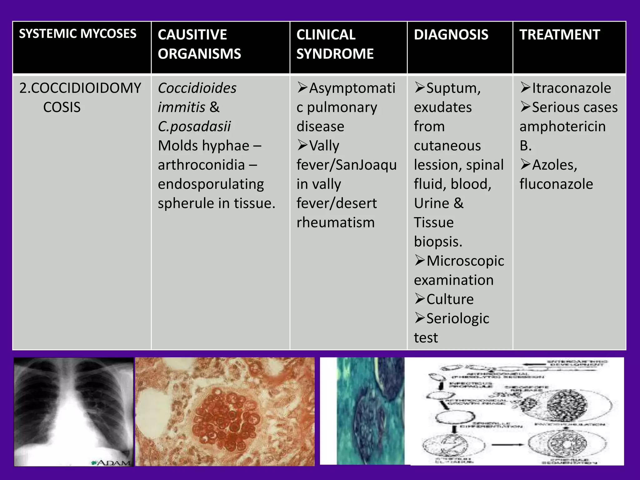SYSTEMIC MYCOSES   CAUSITIVE             CLINICAL         DIAGNOSIS         TREATMENT
                   ORGANISMS             SYNDROME

2.COCCIDIOIDOMY    Coccidioides          Asymptomati     Suptum,          Itraconazole
   COSIS           immitis &             c pulmonary      exudates          Serious cases
                   C.posadasii           disease          from              amphotericin
                   Molds hyphae –        Vally           cutaneous         B.
                   arthroconidia –       fever/SanJoaqu   lession, spinal   Azoles,
                   endosporulating       in vally         fluid, blood,     fluconazole
                   spherule in tissue.   fever/desert     Urine &
                                         rheumatism       Tissue
                                                          biopsis.
                                                          Microscopic
                                                          examination
                                                          Culture
                                                          Seriologic
                                                          test
 