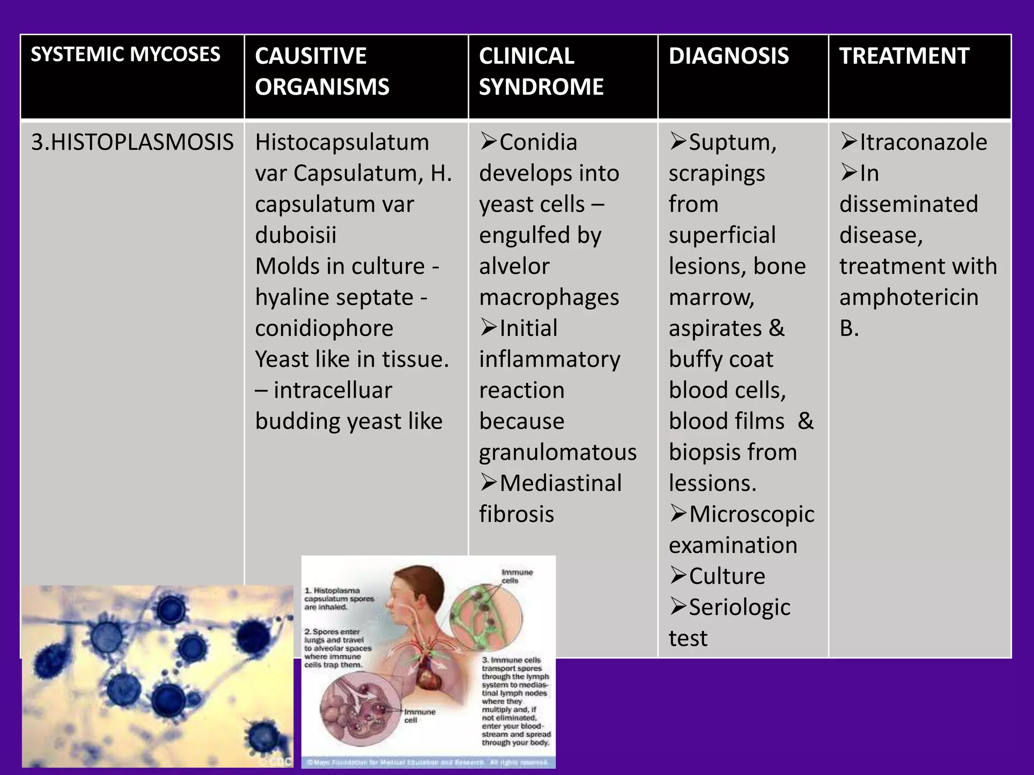 SYSTEMIC MYCOSES    CAUSITIVE            CLINICAL        DIAGNOSIS       TREATMENT
                    ORGANISMS            SYNDROME

3.HISTOPLASMOSIS Histocapsulatum         Conidia        Suptum,        Itraconazole
                 var Capsulatum, H.      develops into   scrapings       In
                 capsulatum var          yeast cells –   from            disseminated
                 duboisii                engulfed by     superficial     disease,
                 Molds in culture -      alvelor         lesions, bone   treatment with
                 hyaline septate -       macrophages     marrow,         amphotericin
                 conidiophore            Initial        aspirates &     B.
                 Yeast like in tissue.   inflammatory    buffy coat
                 – intracelluar          reaction        blood cells,
                 budding yeast like      because         blood films &
                                         granulomatous   biopsis from
                                         Mediastinal    lessions.
                                         fibrosis        Microscopic
                                                         examination
                                                         Culture
                                                         Seriologic
                                                         test
 