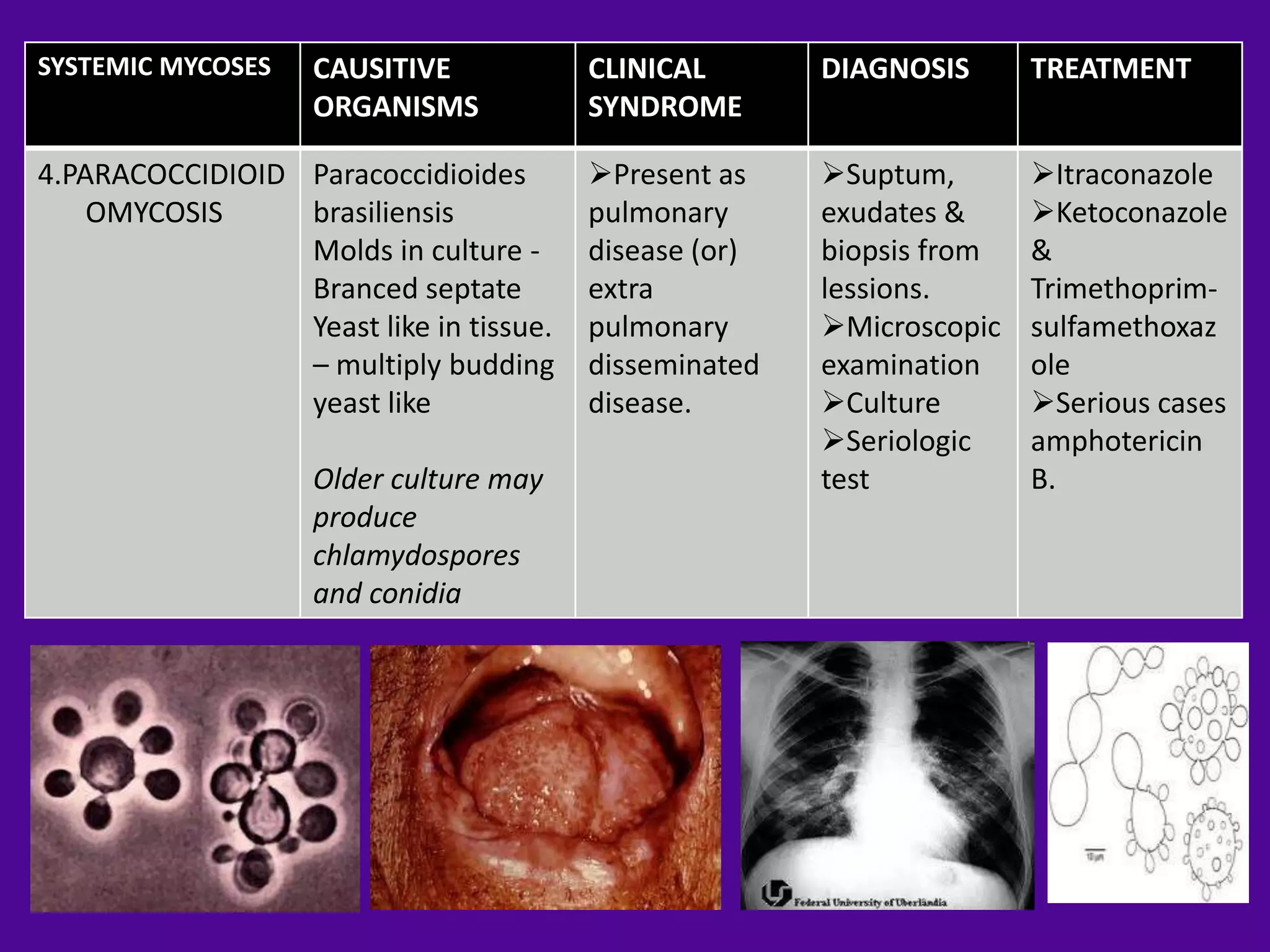 SYSTEMIC MYCOSES    CAUSITIVE            CLINICAL       DIAGNOSIS      TREATMENT
                    ORGANISMS            SYNDROME

4.PARACOCCIDIOID Paracoccidioides        Present as    Suptum,       Itraconazole
    OMYCOSIS     brasiliensis            pulmonary      exudates &     Ketoconazole
                 Molds in culture -      disease (or)   biopsis from   &
                 Branced septate         extra          lessions.      Trimethoprim-
                 Yeast like in tissue.   pulmonary      Microscopic   sulfamethoxaz
                 – multiply budding      disseminated   examination    ole
                 yeast like              disease.       Culture       Serious cases
                                                        Seriologic    amphotericin
                    Older culture may                   test           B.
                    produce
                    chlamydospores
                    and conidia
 