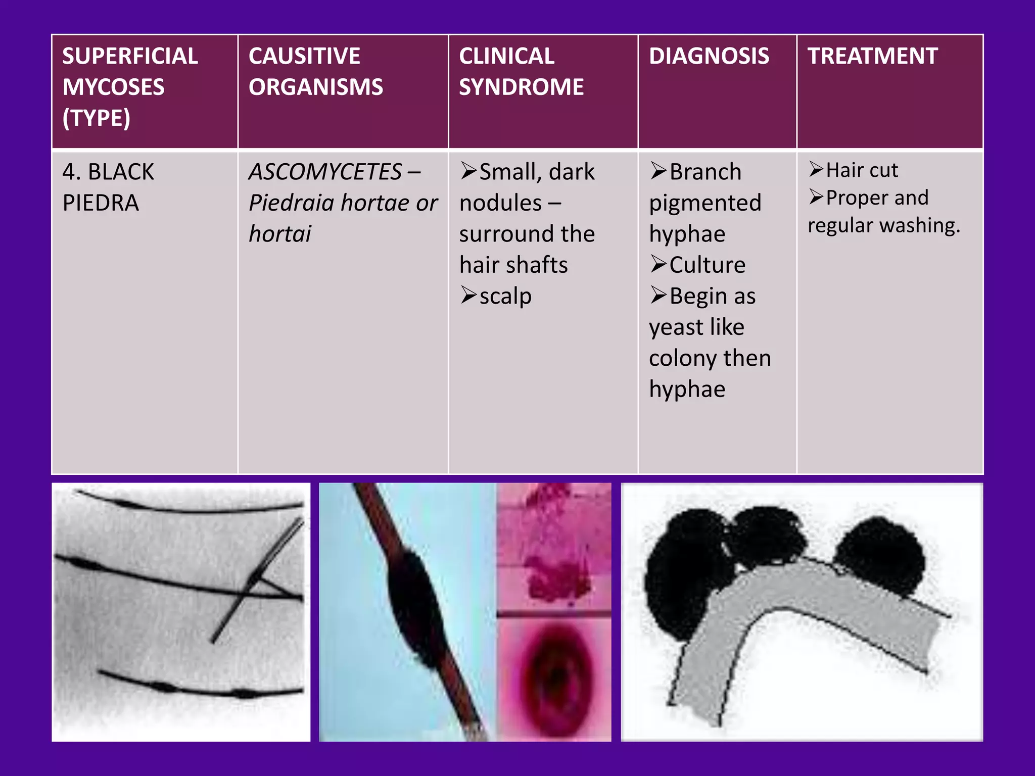 SUPERFICIAL   CAUSITIVE         CLINICAL        DIAGNOSIS     TREATMENT
MYCOSES       ORGANISMS         SYNDROME
(TYPE)

4. BLACK      ASCOMYCETES – Small, dark        Branch       Hair cut
PIEDRA        Piedraia hortae or nodules –      pigmented     Proper and
              hortai             surround the   hyphae        regular washing.
                                 hair shafts    Culture
                                 scalp         Begin as
                                                yeast like
                                                colony then
                                                hyphae
 