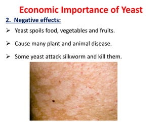 Economic Importance of Yeast
2. Negative effects:
 Yeast spoils food, vegetables and fruits.
 Cause many plant and animal disease.
 Some yeast attack silkworm and kill them.
 