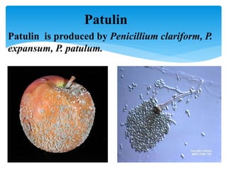 Patulin
Patulin is produced by Penicillium clariform, P.
expansum, P. patulum.
 