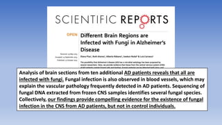 Analysis of brain sections from ten additional AD patients reveals that all are
infected with fungi. Fungal infection is also observed in blood vessels, which may
explain the vascular pathology frequently detected in AD patients. Sequencing of
fungal DNA extracted from frozen CNS samples identifies several fungal species.
Collectively, our findings provide compelling evidence for the existence of fungal
infection in the CNS from AD patients, but not in control individuals.
 