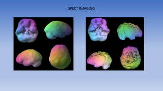 SPECT IMAGING
 