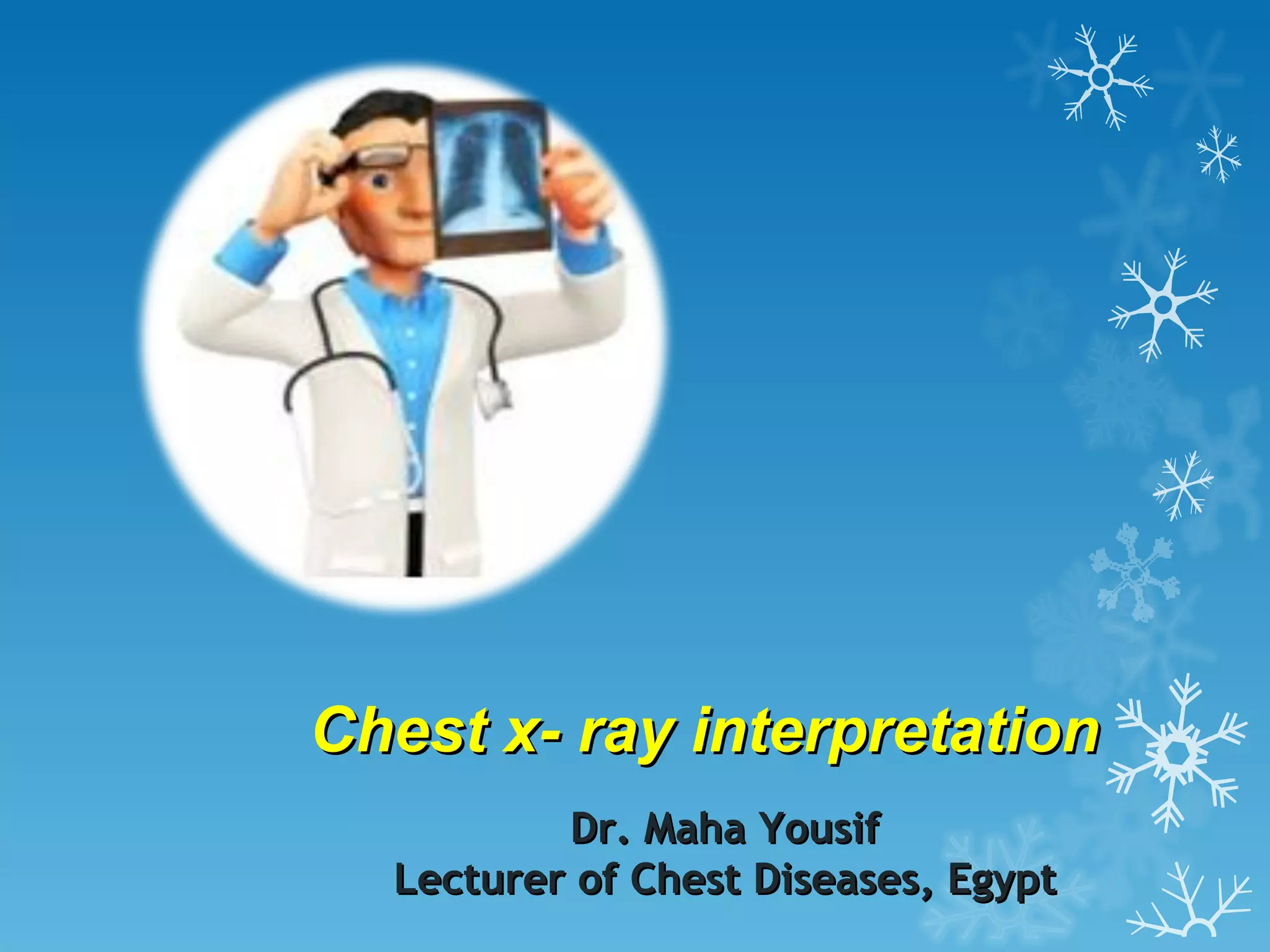 Chest x- ray interpretation Dr. Maha Yousif Lecturer of Chest Diseases, Egypt