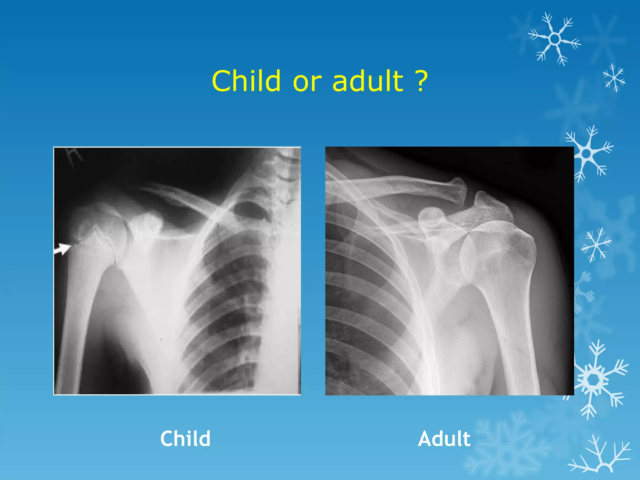 Child or adult ? Child Adult