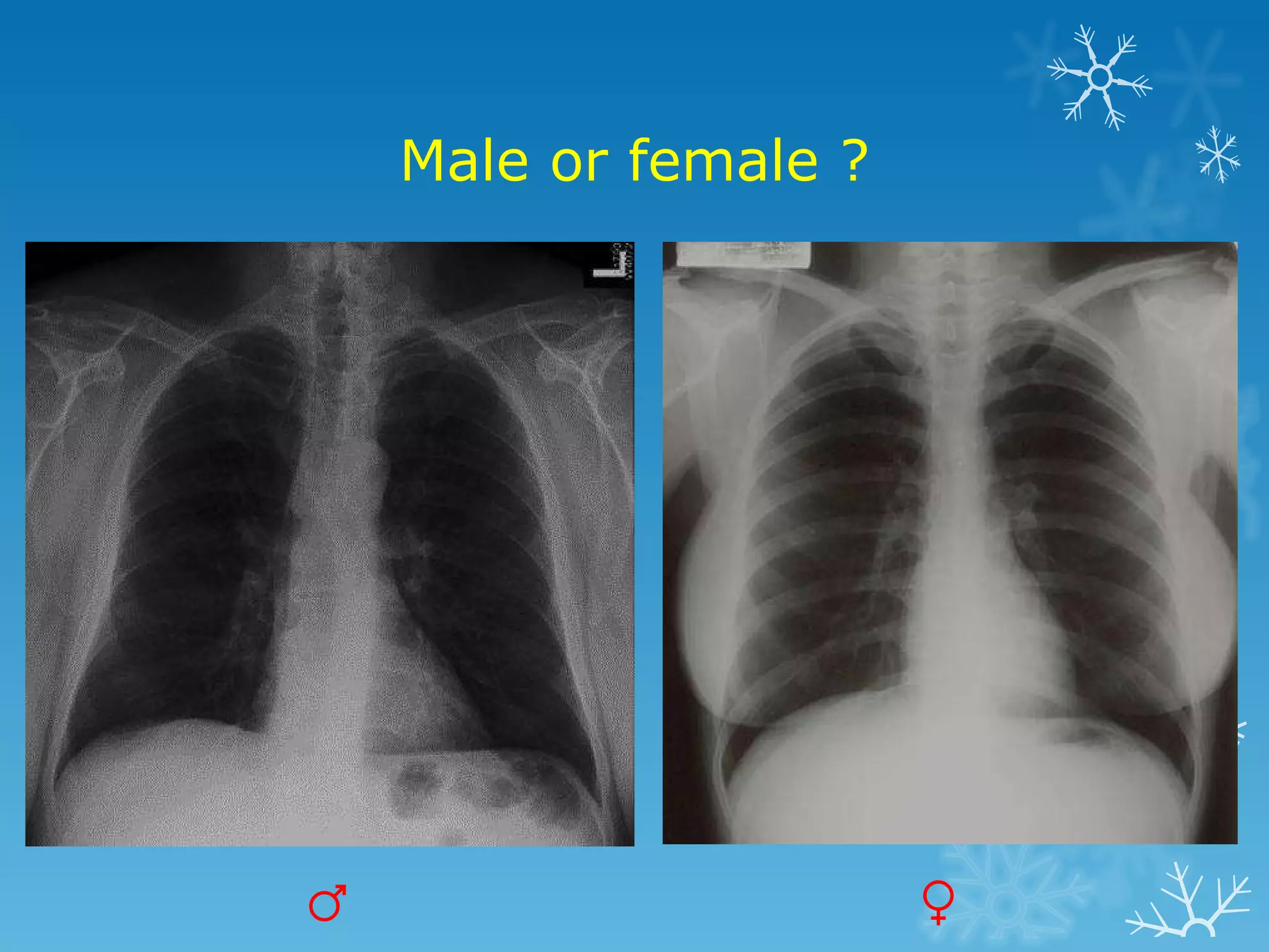 Male or female ? ♂ ♀