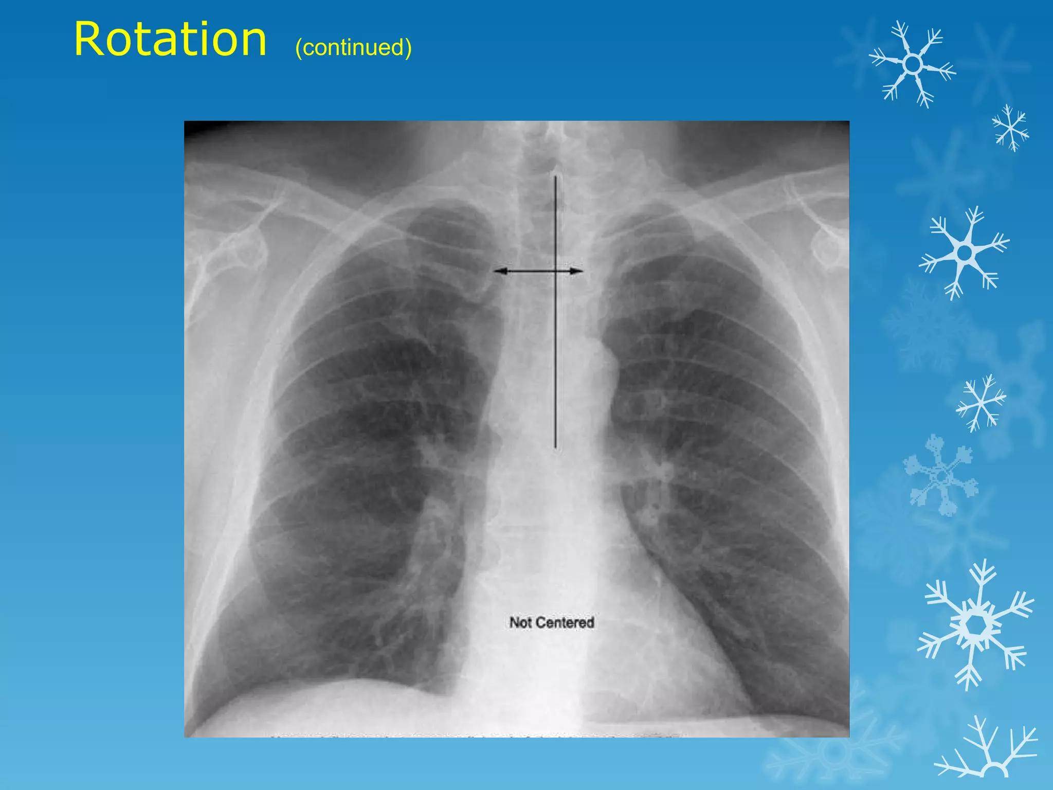 Rotation (continued)