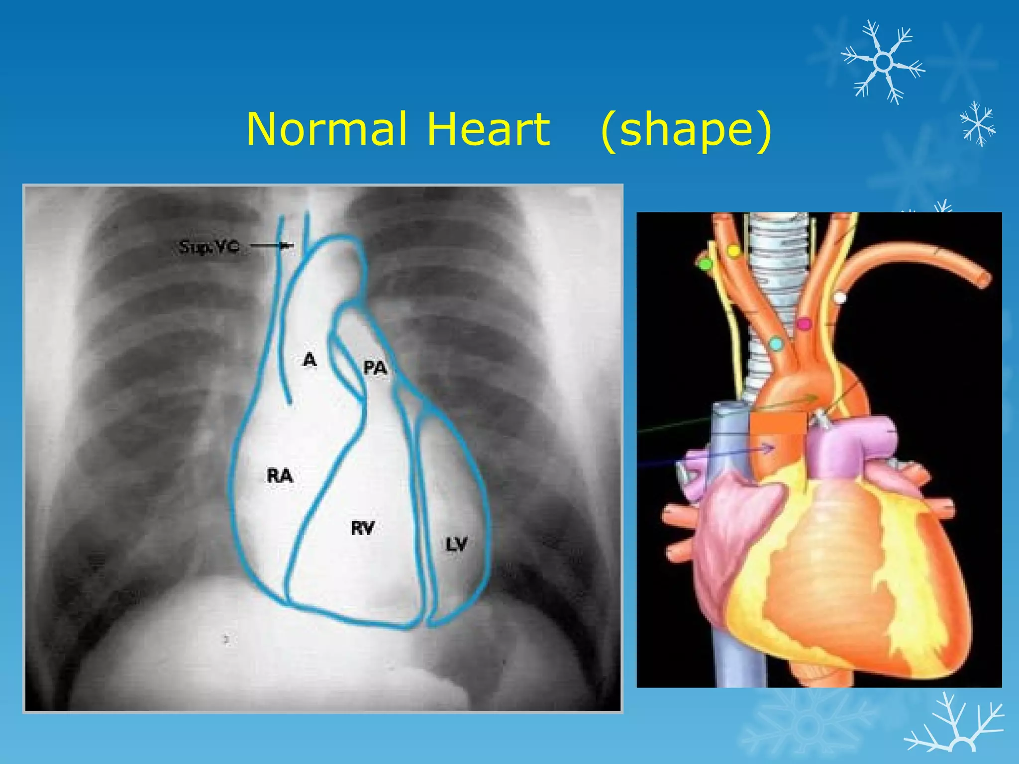 Normal Heart (shape)