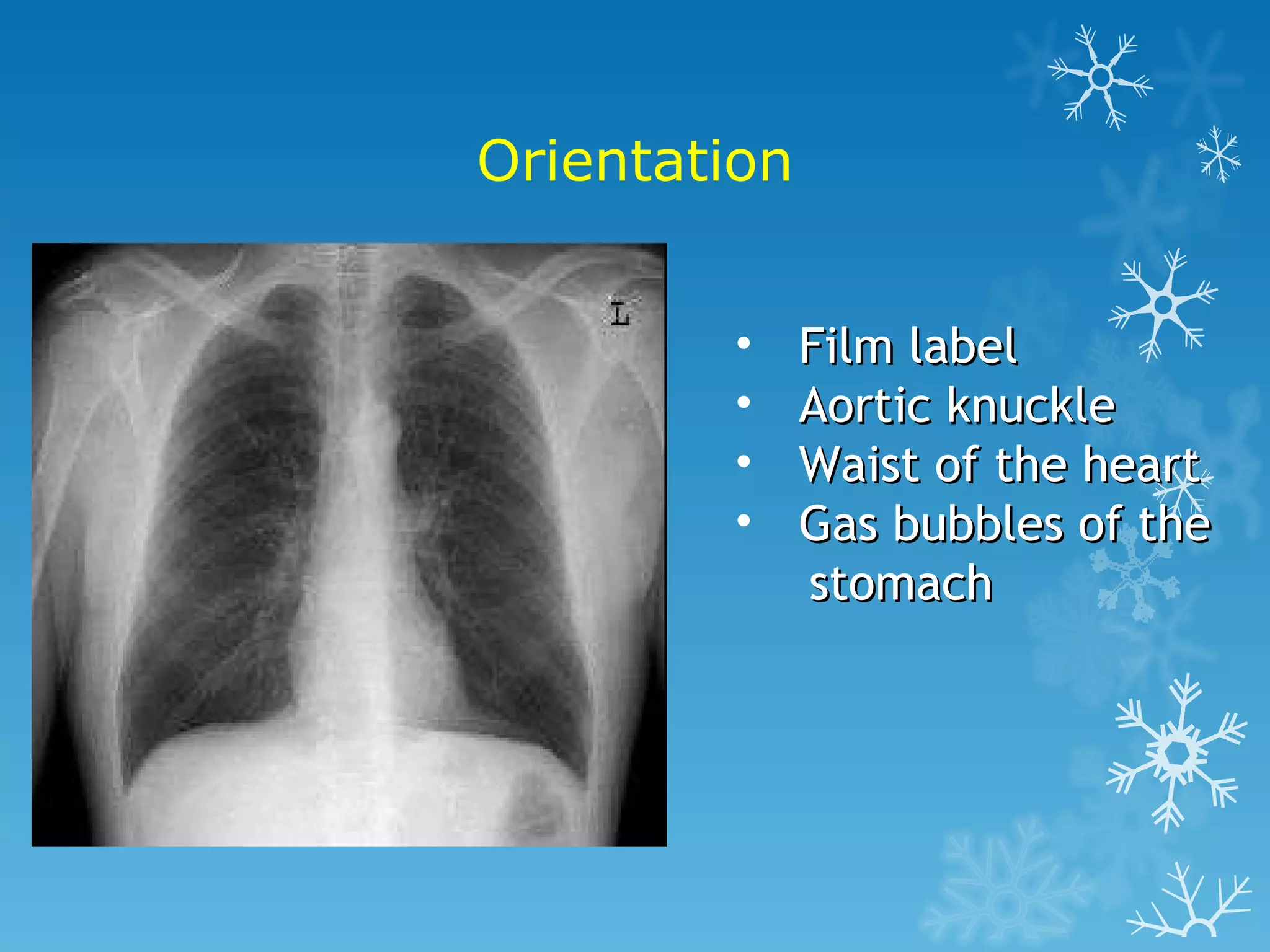 Orientation Film label Aortic knuckle Waist of the heart Gas bubbles of the stomach