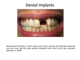 Dental Implants
Restorative Dentistry: Donât stop your smile coming off naturally because
you can now get the best dental implants from one of the top cosmetic
dentists in India!