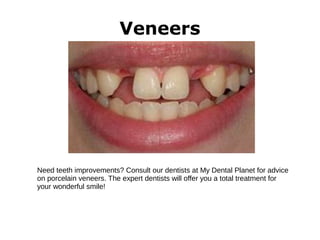 Veneers
Need teeth improvements? Consult our dentists at My Dental Planet for advice
on porcelain veneers. The expert dentists will offer you a total treatment for
your wonderful smile!