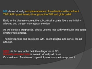 MR shows virtually complete absence of myelination with confluent
T2/FLAIR hyperintensity throughout the WM and globi pallidi.
Early in the disease course, the subcortical arcuate fibers are initially
affected and the gyri may appear swollen.
As the disease progresses, diffuse volume loss with ventricular and sulcal
enlargement ensues.
The hemispheric and cerebellar WM, basal ganglia, and cortex are all
affected.
MRS - is the key to the definitive diagnosis of CD.
Markedly elevated NAA is seen in virtually all cases.
Cr is reduced. An elevated myoisitol peak is sometimes present.
 