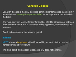 Canavan Disease
Canavan disease is the only identified genetic disorder caused by a defect in
a metabolite— N-acetyl-L-aspartate (NAA) —that is produced exclusively in
the brain.
The most common form by far is infantile CD. Infantile CD presents between
three and six months and is characterized by hypotonia, macrocephaly, and
seizures.
Death between one or two years is typical.
Imaging
NECT shows a large head with diffuse WM hypodensity in the cerebral
hemispheres and cerebellum.
The globi pallidi also appear hypodense. CD does not enhance.
 