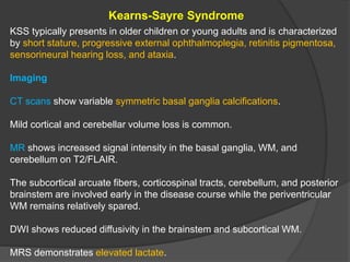 Kearns-Sayre Syndrome
KSS typically presents in older children or young adults and is characterized
by short stature, progressive external ophthalmoplegia, retinitis pigmentosa,
sensorineural hearing loss, and ataxia.
Imaging
CT scans show variable symmetric basal ganglia calcifications.
Mild cortical and cerebellar volume loss is common.
MR shows increased signal intensity in the basal ganglia, WM, and
cerebellum on T2/FLAIR.
The subcortical arcuate fibers, corticospinal tracts, cerebellum, and posterior
brainstem are involved early in the disease course while the periventricular
WM remains relatively spared.
DWI shows reduced diffusivity in the brainstem and subcortical WM.
MRS demonstrates elevated lactate.
 