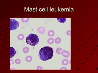 Mast cell leukemiaMast cell leukemia
 