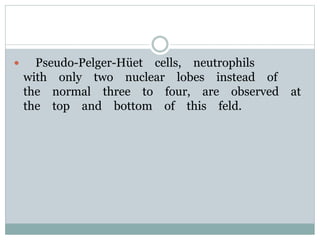  Pseudo-Pelger-Hüet cells, neutrophils
with only two nuclear lobes instead of
the normal three to four, are observed at
the top and bottom of this feld.
 