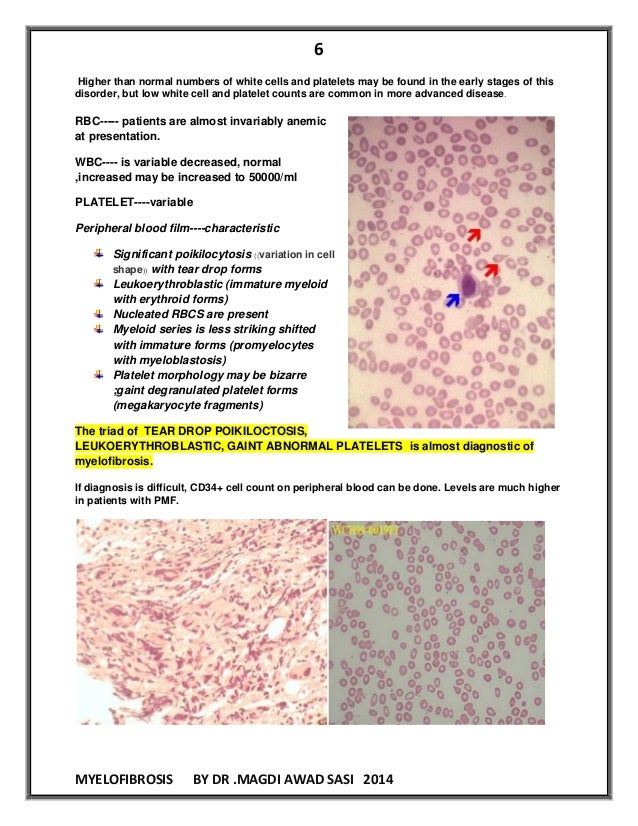mental status examination sle report mental status examination sle report 28 images karvy mental status examination sle report mental status examination sle report 28 images karvy