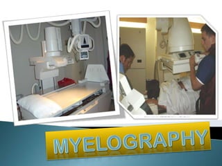 Myelogram